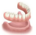 Perfect Smile complete-removable-denture